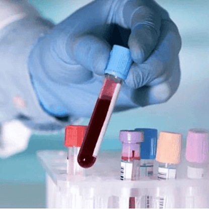Laboratorio de Análisis Clínicos NSB Biometría Hematica